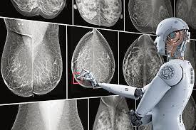   دراسة تؤكد: الذكاء الاصطناعي يساعد فى اكتشاف سرطان الثدي 