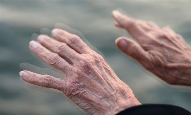 اكتشاف جديد يساعد في إيقاف تطور مرض شلل الرعاش