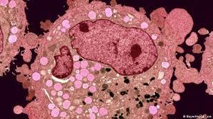   دراسة: أمل جديد لمكافحة السرطان وكلمة السر.. "بكتيريا الأمعاء"