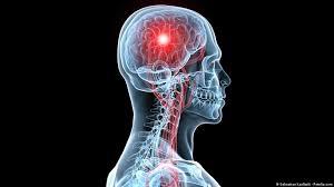   دراسة حديثة: ٩٤٪ من الأشخاص عرضة للإصابة بالسكتات الدماغية والسبب إصابات الرأس