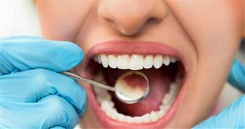 شركة يابانية بصدد تطوير أول دواء في العالم لتحفيز نمو أسنان جديدة
