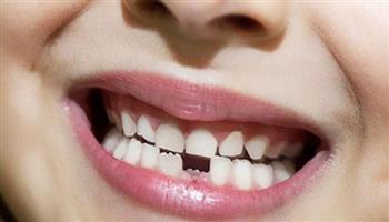 شركة يابانية تطور دواء يساعد على إنبات أسنان جديدة