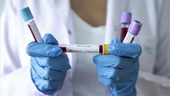   "الصحة العالمية": أكثر من 1.1 مليون حالة إصابة جديدة بفيروس كورونا