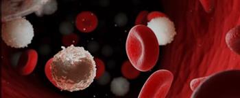   أنواع سرطان الدم "اللوكيميا" وكيفية علاجه