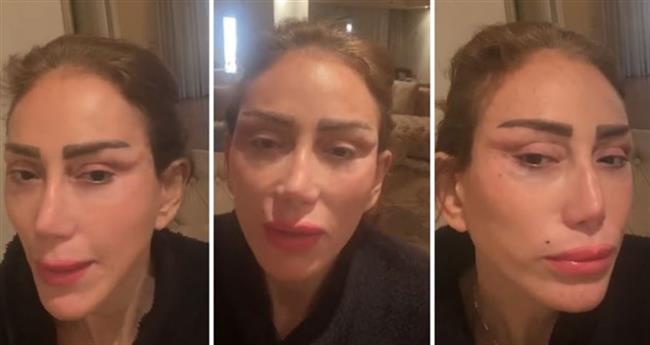 ريهام سعيد تتهم طبيب تجميل شهيرا بتشويه وجهها