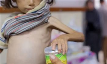   (أونروا): نقص حليب الأطفال في غزة يُعرض حياة أكثر من 8500 رضيع للخطر