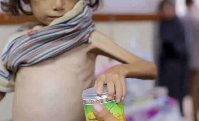 (أونروا): نقص حليب الأطفال في غزة يُعرض حياة أكثر من 8500 رضيع للخطر