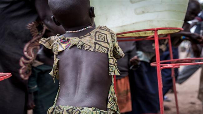 بسبب "الكوليرا".. وفاة أكثر من 70 شخصا خلال أسبوع في شمال جنوب السودان