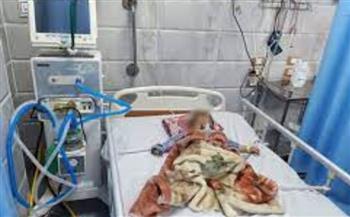   فريق طبي بمستشفى الزقازيق العام ينقذ حياة طفل عمره 10 شهور بعد توقف عضلة القلب