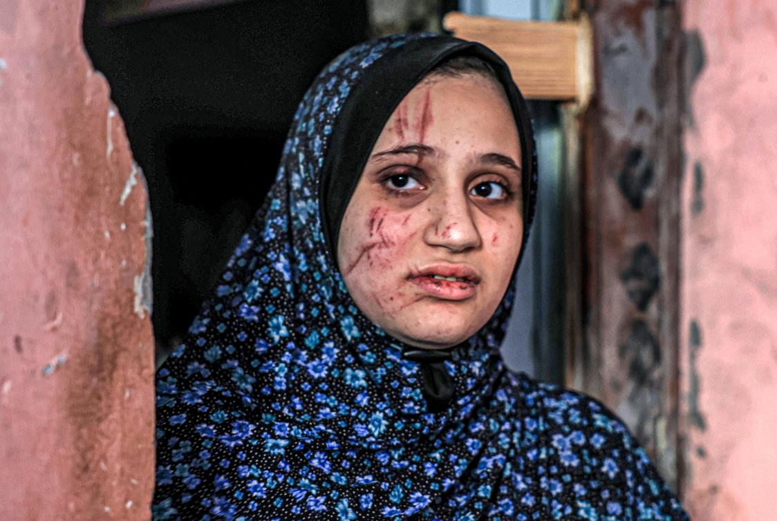 الأمم المتحدة : "حربًا ضد النساء" في قطاع غزة