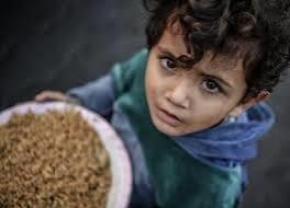   كمال عدوان : استشهاد عدد من الأطفال بسبب الطعام