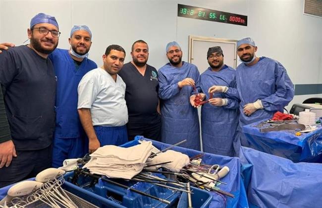 لأول مرة .. إجراء عملية ويبل بالمنظار بمستشفيات جامعة قناة السويس
