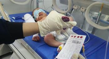   الصحة: فحص 432 ألف طفل حديث الولادة ضمن مبادرة الكشف المبكر عن الأمراض الوراثية لحديثي الولادة