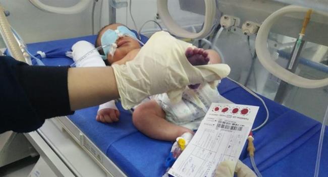 الصحة: فحص 432 ألف طفل حديث الولادة ضمن مبادرة الكشف المبكر عن الأمراض الوراثية لحديثي الولادة