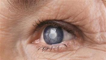   دراسة: كثير من كبار السن لا يدركون إصابتهم بـ الجلوكوما المسببة لفقدان البصر