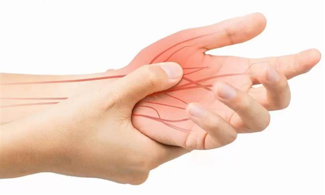 إلتهاب الأعصاب.. ما الأسباب وطرق العلاج؟