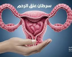   وزارة الصحة تكشف كيف يتم الوقاية من سرطان عنق الرحم بنسبة 100%؟