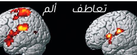 الخلايا العصبية المرآتية... كيف تنتقل المشاعر السلبية من شخص لآخر دون وعي؟