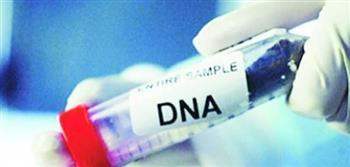 حكم إثبات النسب بـDnA