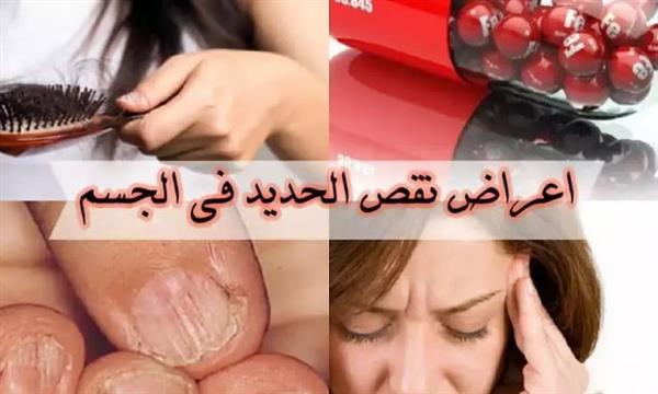 تعرف على أهم علامات نقص الحديد في جسمك