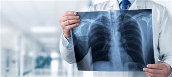   في اليوم العالمي للأشعة السينية.. كيف غيّر الضوء الخفي وجه الطب وأنقذ ملايين الأرواح