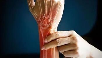 مرق العظام.. الإكسير الذهبي لصحة الجسم من الترطيب إلى مقاومة الالتهابات