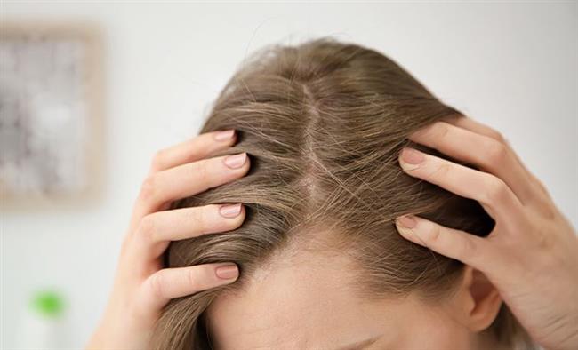 حبوب فروة الرأس .. أسباب خفية وطرق فعّالة للعلاج والوقاية