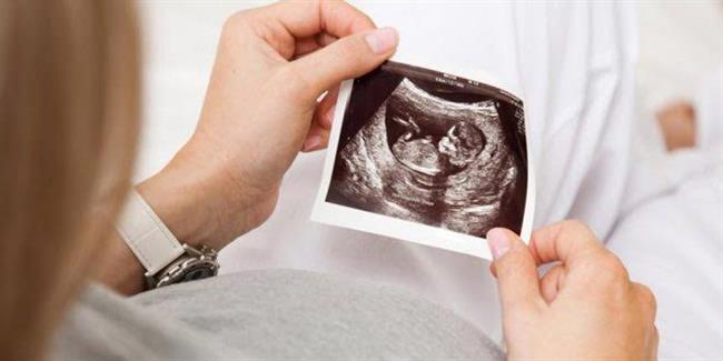 استخدام تقنيات جديدة لفحص سلامة الجنين