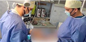 فريق طبي بمستشفي صدر المعمورة ينجح في استئصال خراج من رئة مريض