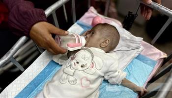   "الأونروا": طفلا من كل 10 أطفال في غزة يخضعون للفحص يعاني من سوء التغذية