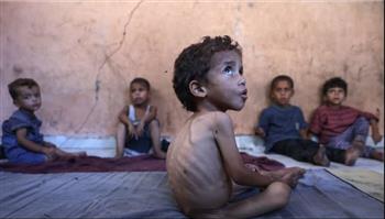   80 طفل فلسطيني ماتوا من الجوع في غزة