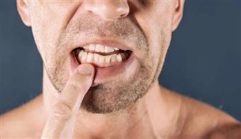   علاج فوري للتخلص من ألم تسوس الأسنان