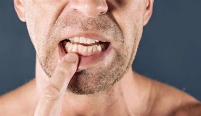علاج فوري للتخلص من ألم تسوس الأسنان