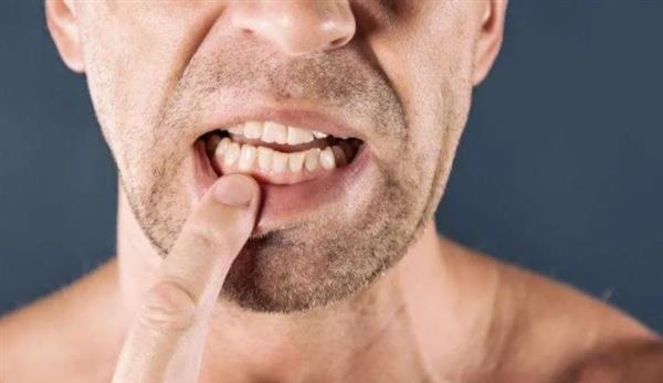علاج فوري للتخلص من ألم تسوس الأسنان