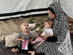 بعد معاناة من الجوع ..وفاة الطفل الفلسطيني صاحب عبارة "أنا جعان"