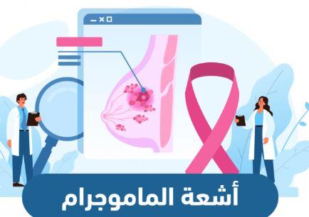الماموجرام.. خط الدفاع الأول ضد سرطان الثدي