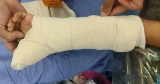صحة دمياط تنقذ طفلًا من قطع أوتار اليد بعد سقوط لوح زجاجي