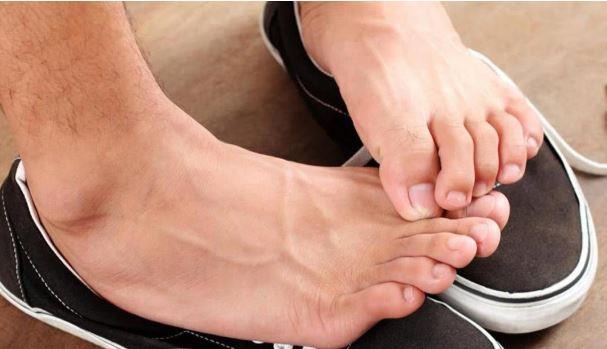 رائحة القدمين الكريهة.. أسبابها الخفية وطرق التخلص منها