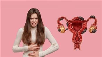   أكياس الشوكولاتة.. العدو الخفي لصحة المرأة والخصوبة