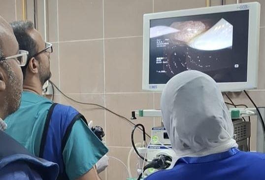 استئصال ورم بدون جراحة بالقنوات المرارية بوحدة المناظير بمستشفى أحمد ماهر التعليمي