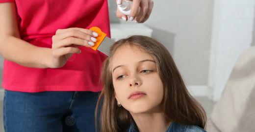 القمل في المدارس.. كيف نحمي أطفالنا من العدوى المزعجة