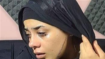   بعد أيام قليلة من زفافها.. الطب الشرعي يكشف تفاصيل إصابات "عروس مصر القديمة" بعد التشويه