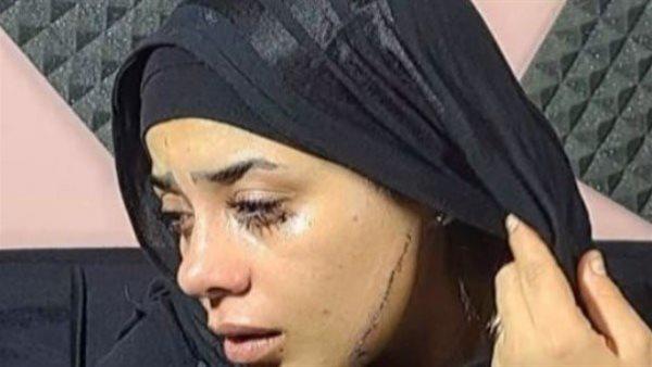 بعد أيام قليلة من زفافها.. الطب الشرعي يكشف تفاصيل إصابات "عروس مصر القديمة" بعد التشويه