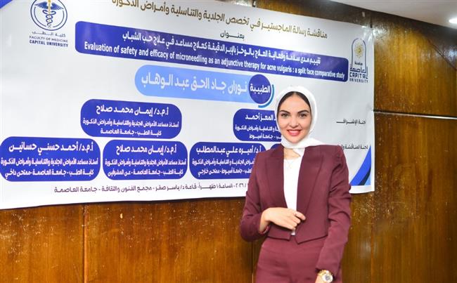 مصرية تكشف علميًا فعالية الإبر الدقيقة في علاج حب الشباب