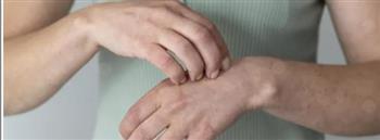 أسباب تنميل اليدين أثناء النوم.. متى يكون عرضًا عابرًا ومتى يستدعي القلق؟