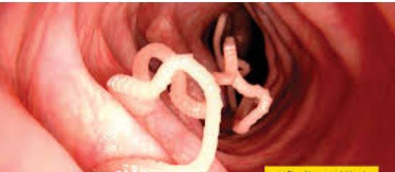 مرض الأكياس المائية: خطر خفي ينتقل من حيواناتك إلى عائلتك – كيف تحمي نفسك؟