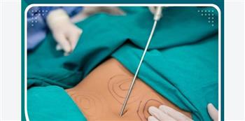   وفاة فتاة أثناء عملية شفط دهون داخل مركز تجميل غير مرخص بالهرم