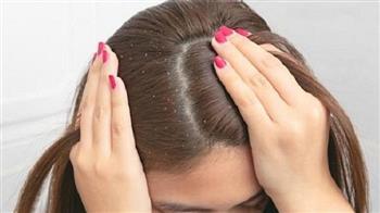 طرق طبيعية للتخلص من قشرة الشعر وتهدئة فروة الرأس