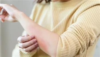 أفضل الطرق الطبيعية للتخلص من جلد الوزة