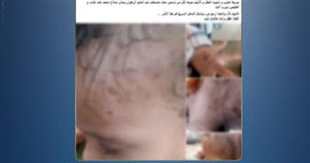   الأمن يكشف ملابسات بلاغ كيدي حول طفل الشرقية  